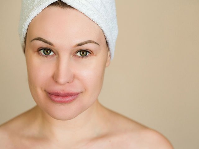 Clear, even skin a few days after a light chemical peel